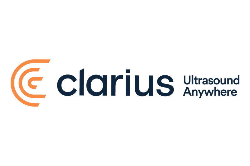 clarius-ultrasound